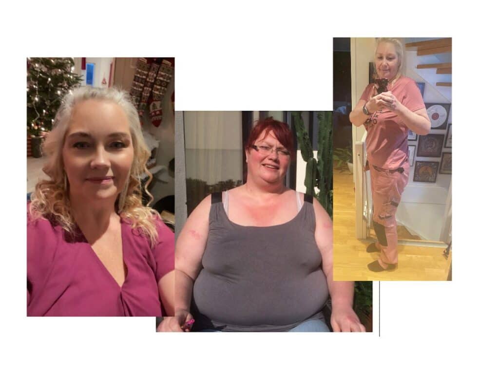 Bilde av kvinne som har brukt wegovy og blitt slank